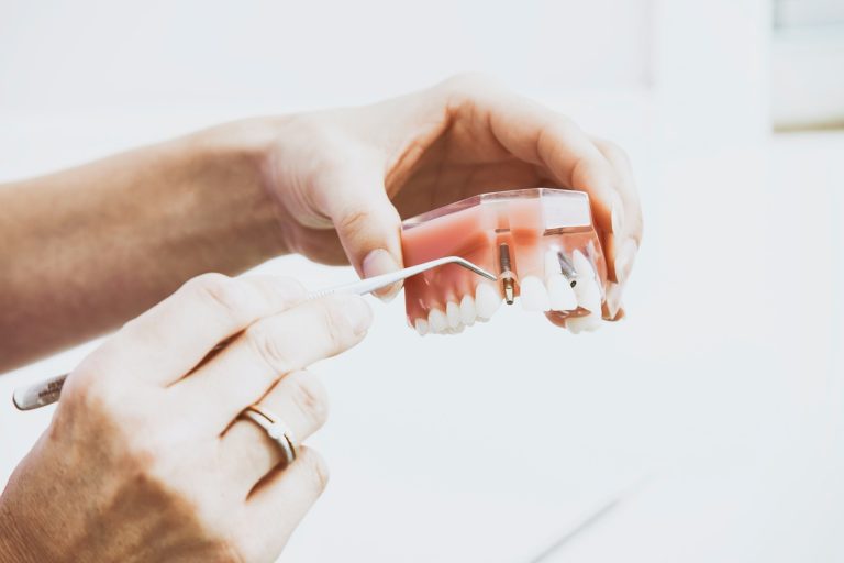 Tips For Reducing The Chances Of Dental Emergencies